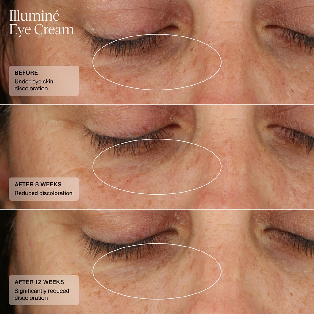 Senté Illuminé Eye Cream | Diminish Dark Circles, Discoloration, Redness, and Puffiness Around The Eyes | with Patented HSA, Niacinamide and Peptides | 0.5 Oz