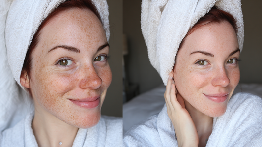 Morning vs Night Skincare: What You Really Need