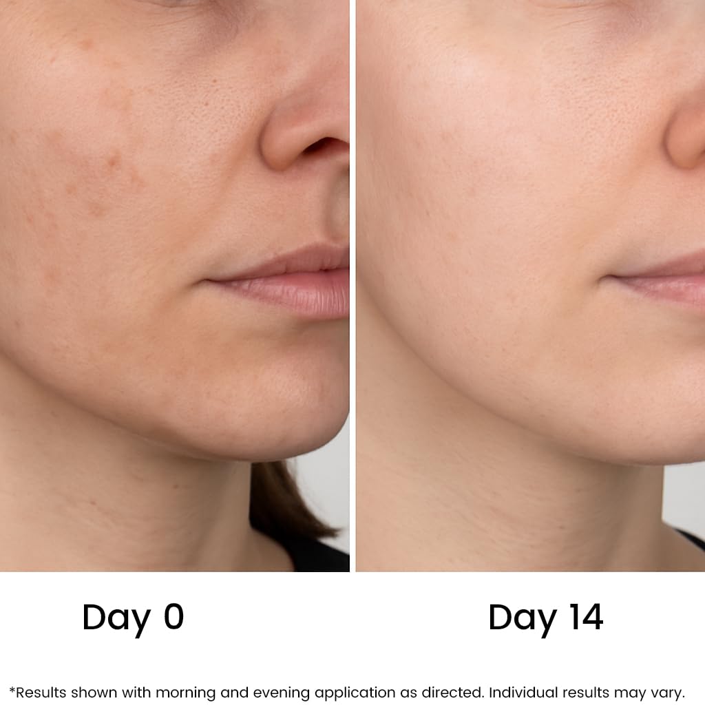 All Natural 20% Vitamin C Serum + 6 Active Boosters for Face, Dark Spots, Wrinkles, Brightening, Hydrating, Even Tone, Healthy Glow with Niacinamide, Hyaluronic Acid, Ferulic Acid, Vitamin E, Peptides