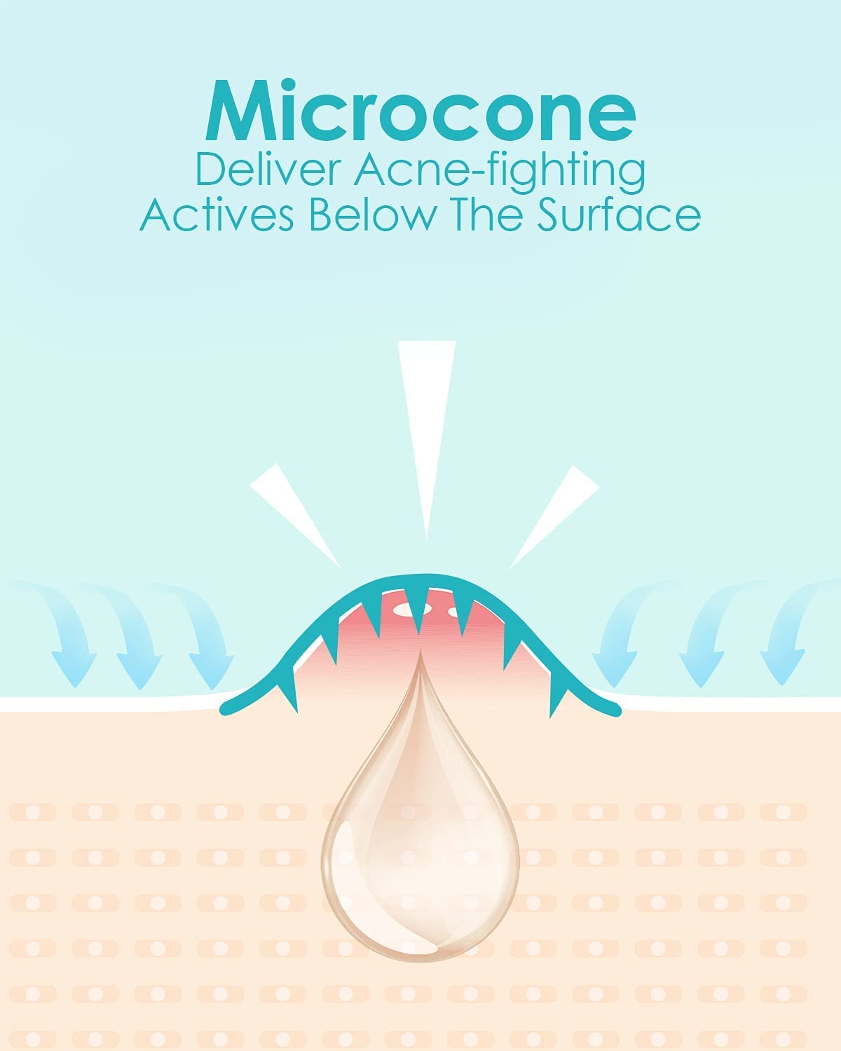 Microdart Acne Patch (72 Patches) - Hyaluronate, Salicylic Acid, Vitamin C, Microdart Pimple Patch for Deep, Early Stage and Hidden Pimples (72 Count (Pack of 1))