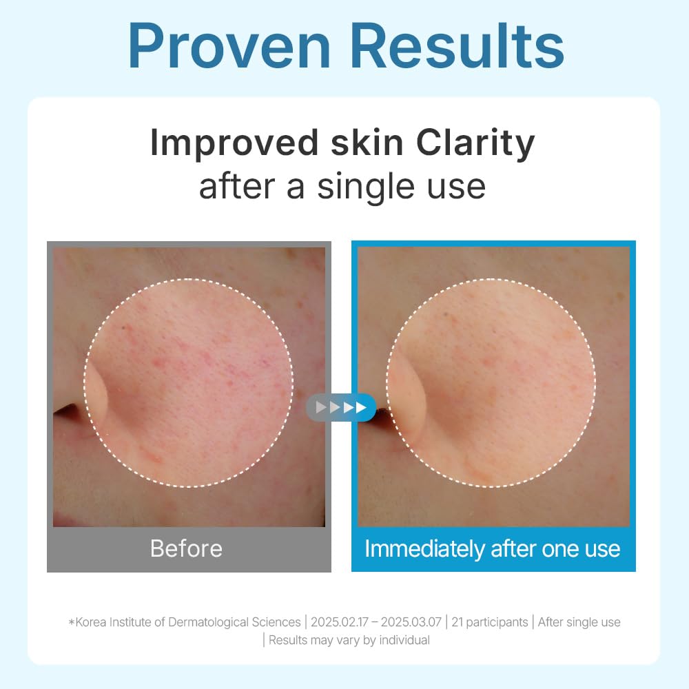 CENTELLIAN 24 Madeca Lab Hyal Waterfull Gel Mask – Deep Hydration with 10-Layer Hyaluronic Acid Complex, Cooling & Soothing, Ultra-Light No-Drip Gel Sheet