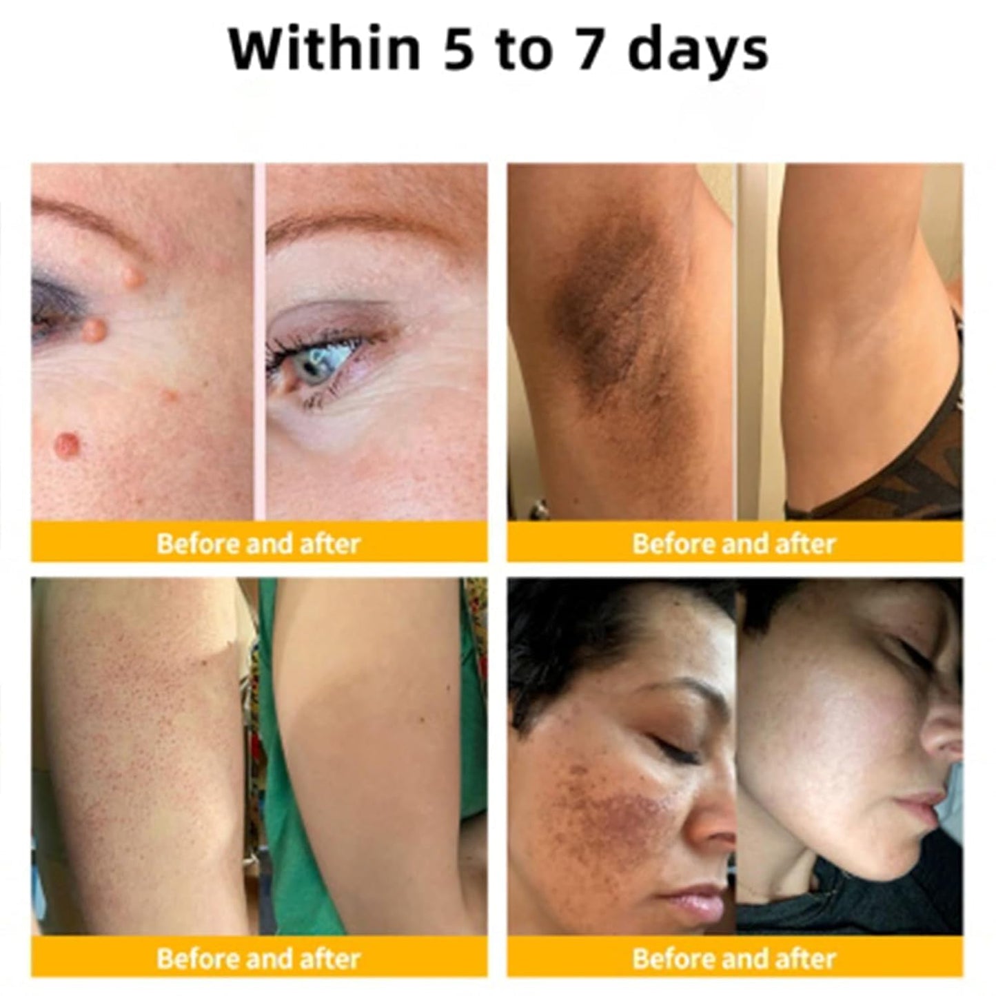 Bee Venom Cream, Professional Bee Venom Cream, Bee Venom Repair Cream for All Parts of The Body (2 Pack)