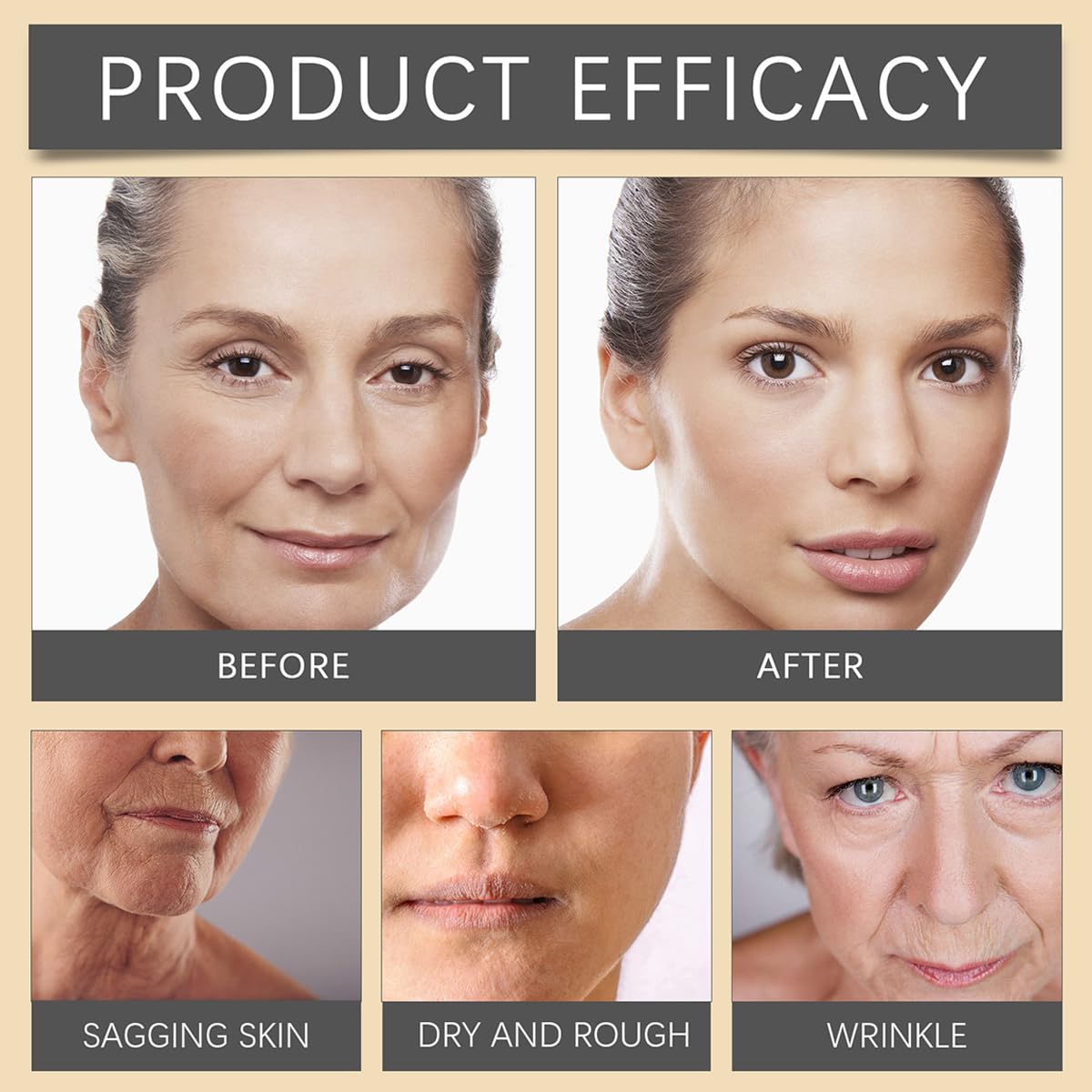 Bee Venom Moisturiser Cream Wrinkle Removal & Firming, Anti-Aging Eye&Face Bee Venom Skin Treatment Cream, Natural And Non-Irritating, Lifting & Recovery For All Skin Type (3 Packs, 60g)