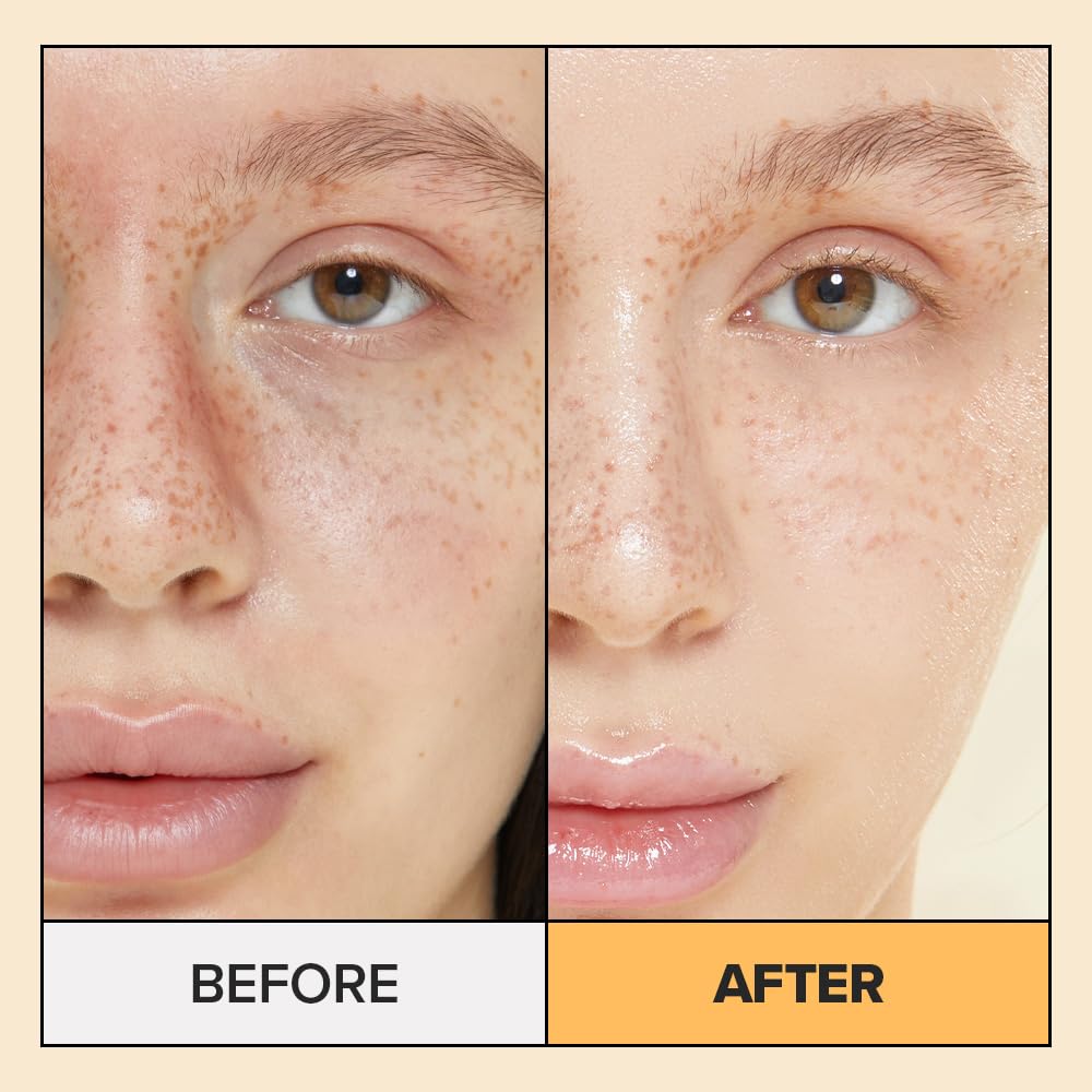 I DEW CARE Korean Glass Skin Real Herb Calendula Sheet Mask - Hot As Sheet Mask | Face Masks Skincare, Moisturizing and Calming for Dry Skin with Calendula Flower Extract, 2% Niacinamide, Kbeauty,10EA