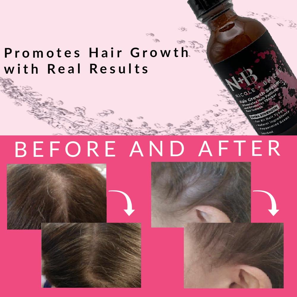 N+B Hair Growth Serum - Helps Promote Thicker, Fuller, & Healthier Hair w/Biotin, Natural-Based Formula, Helps Prevent Hair Fall & Thinning, For Women In All Hair Types - (2oz.) (6-Pack)
