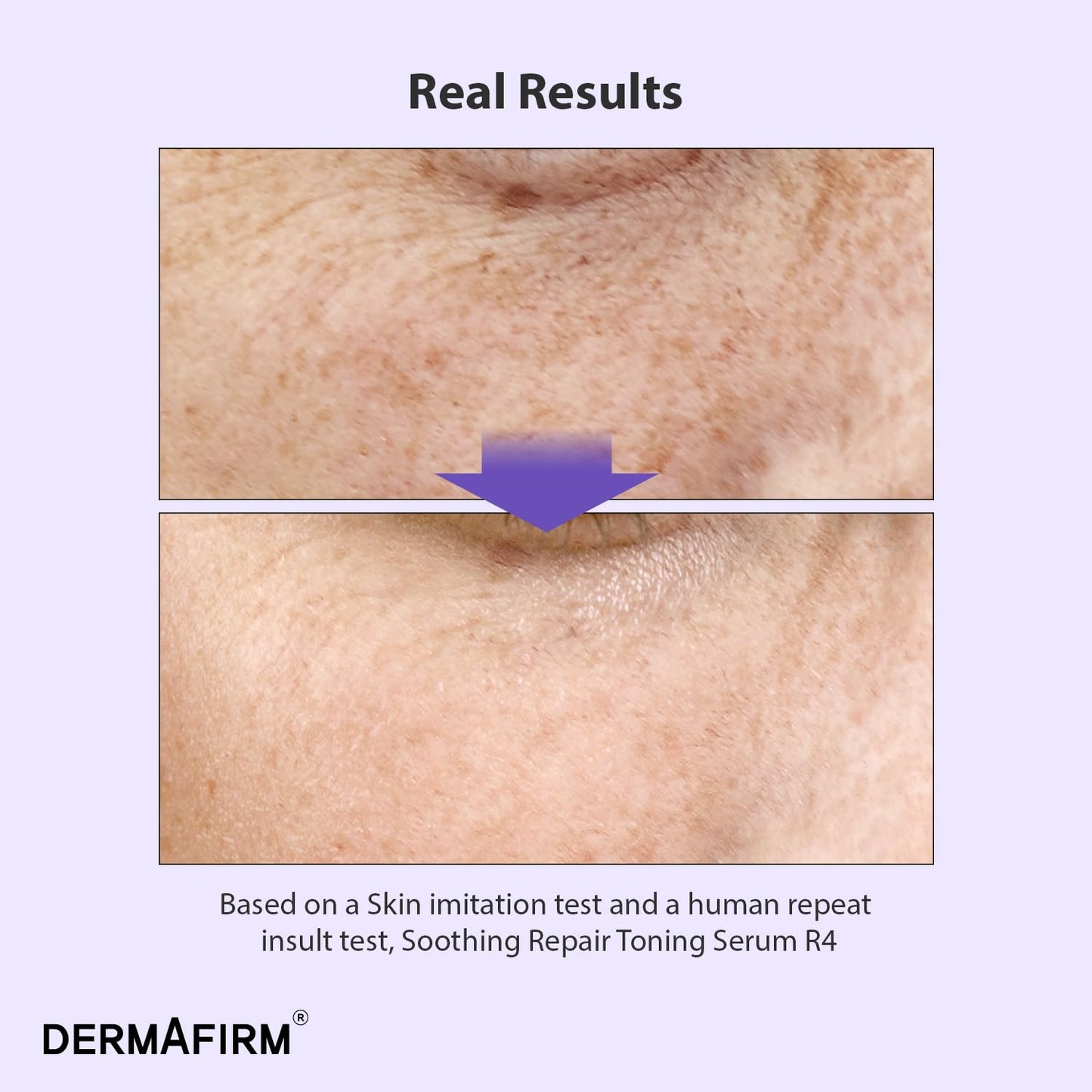 DERMAFIRM Bakuchiol Retinol Serum for Glass Skin with Niacinamide & Peptides | Daily Korean Skin Care for Sensitive Skin | Soothing Repair Toning Serum R4 for Glass Skin