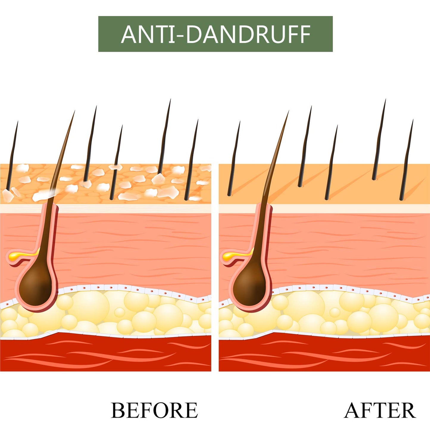 Luseta Tea Tree & Argan Oil Detangling Shampoo & Conditioner Set, 2 x 33.8 Oz