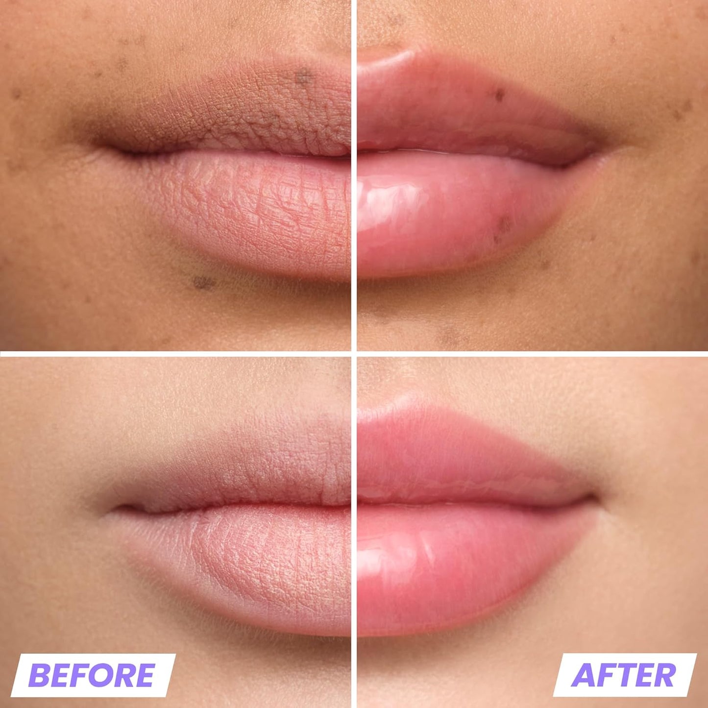 Wonderskin Lip Relapse Plumping Gloss – Lip Plumper Gloss for Fuller-Looking Lips with Hydrating, Non-Sticky, High-Shine Finish