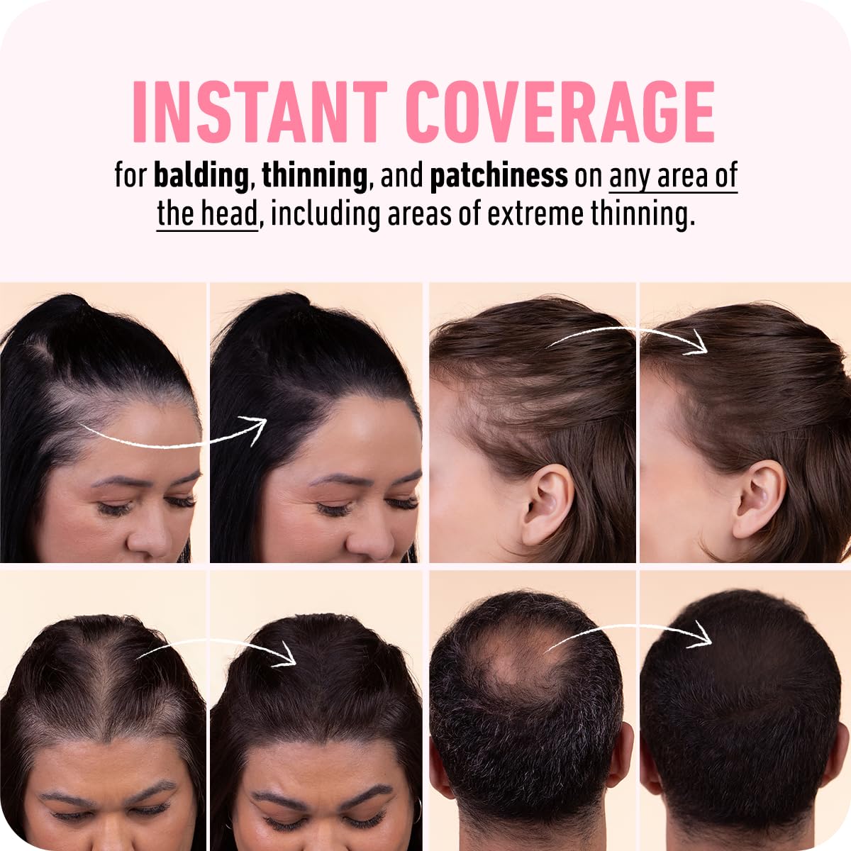 BOLDIFY Hairline Powder - Root Touch Up Hair Color for Gray Coverage - Bald Spot Concealing Hair Powder for Women & Men - 48-Hour Stain-Proof - Medium Brown