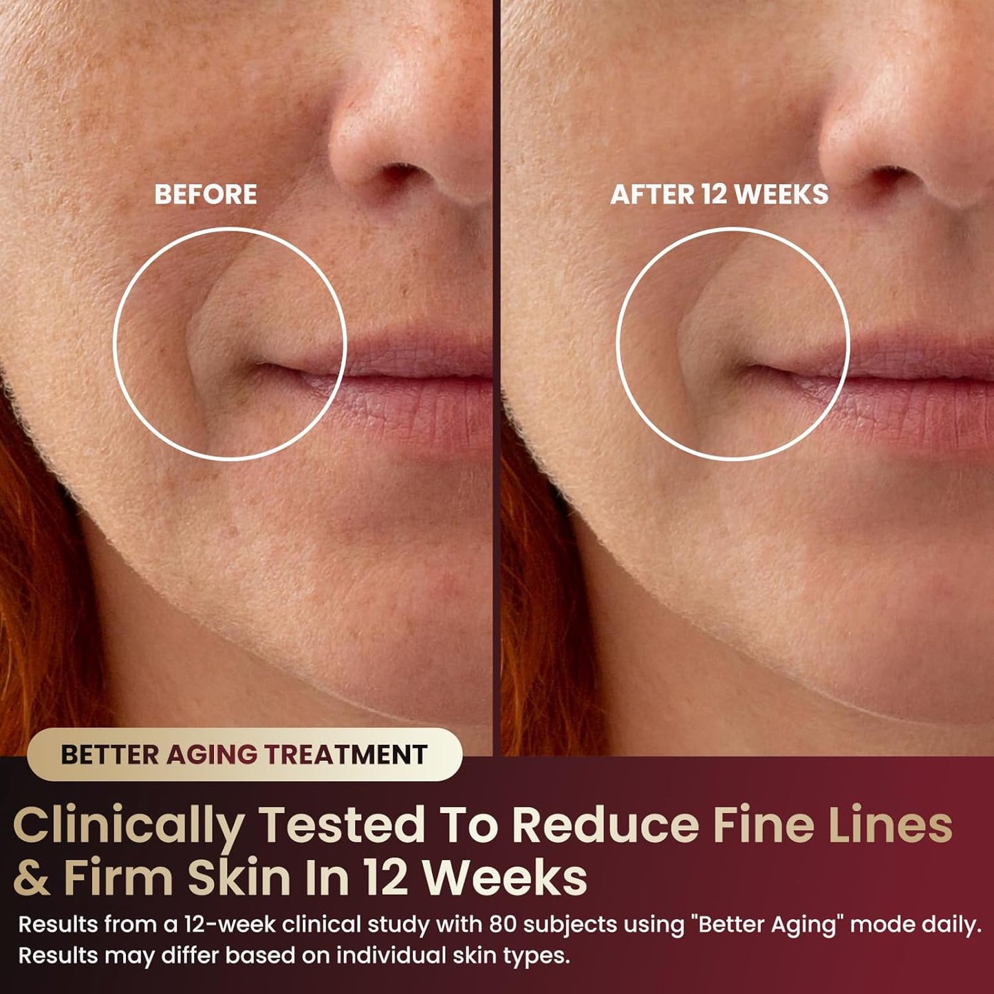 FDA-Cleared Red Light Therapy for Face with 7 Modes & 432 Medical Grade LEDs | LED Face Mask Light Therapy Targeting Anti Aging, Wrinkles & Acne | at-Home Skin Tightening & Collagen Boost