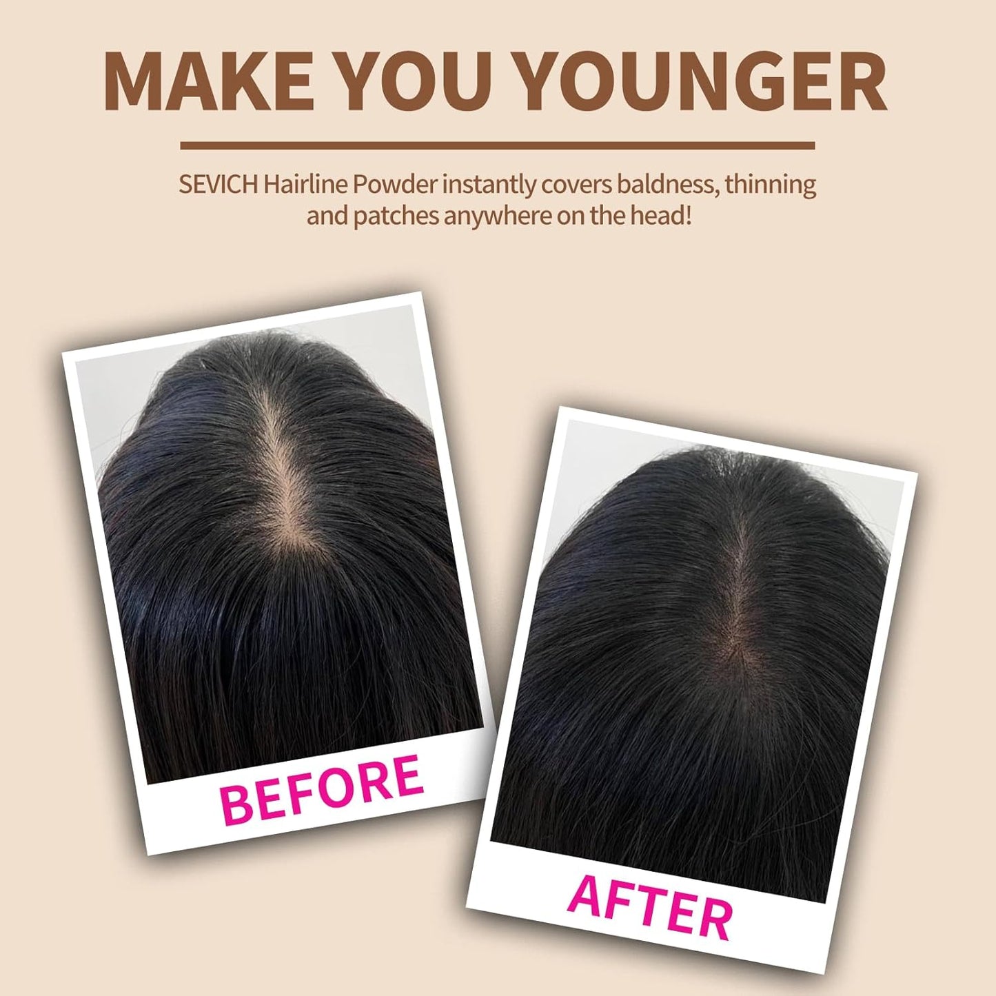 Sevich Hairline Powder: Instantly Conceals Hair Loss and Gray Roots, Grey Windproof & Sweatproof Hair Toppers for Women & Men