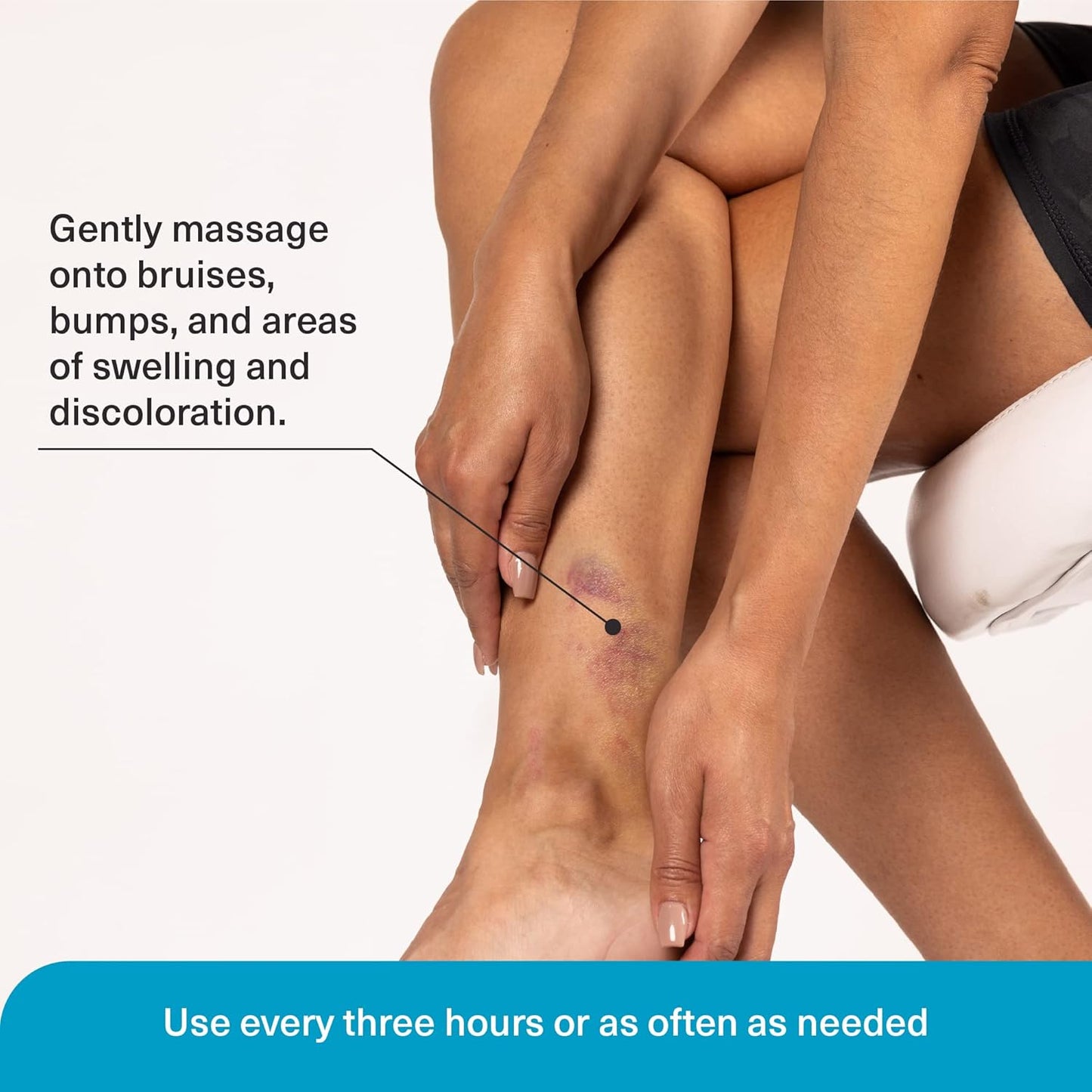 Arnica Bruise Relief Lotion for Bruising, Swelling, & Discoloration On Skin, Natural Skin Care Arnica Bruise Homeopathic Topical Bruise Cream W/Aloe Vera & Collagen, 4 Fl Oz (Pack of 3)