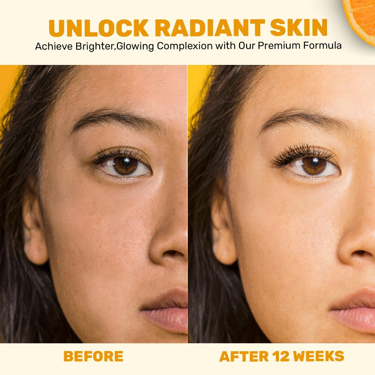 Gentle Vitamin C Serum – Brightening & Hydrating with Citrus Stem Cells and Chamomile, Safe for Rosacea & Sensitive Skin, 1oz