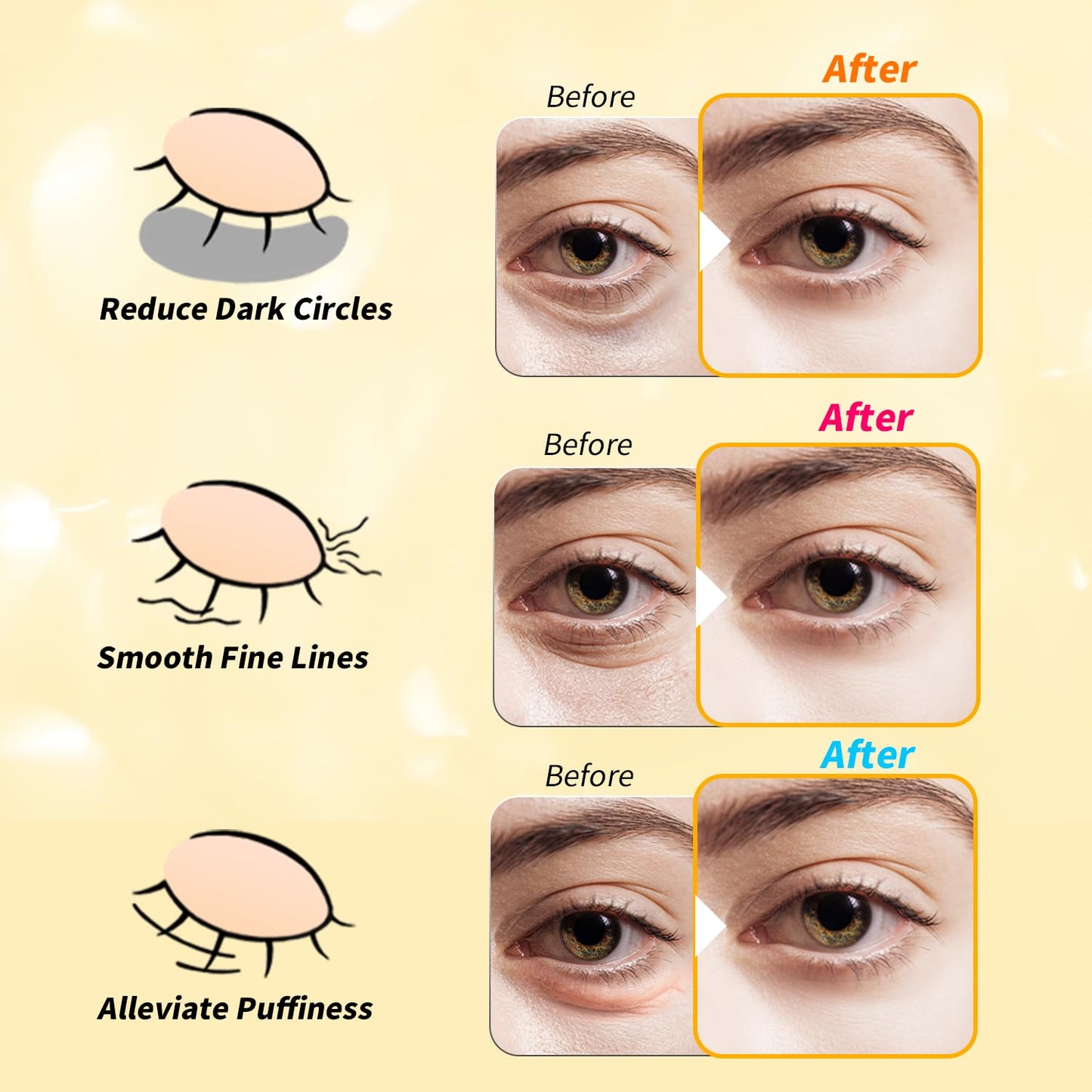 Under Eye Patches(36 Pairs), 24K Gold, Caffeine, Retinol Eye Masks for Puffy Eyes, Wrinkles, Dark Circles, Undereye Bags Treatment - Restoring & Awakening & Moisturizer Skin care Gift for Women