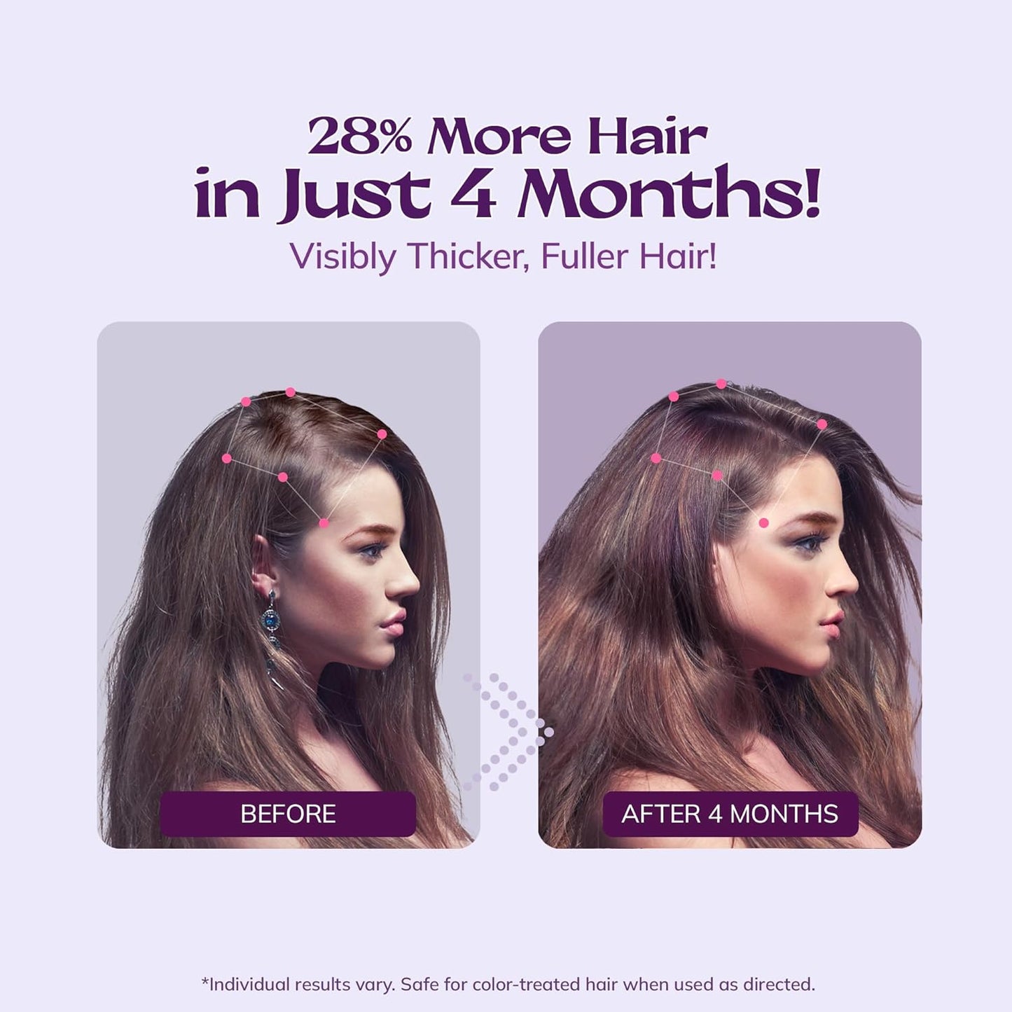 Women's 5% Minoxidil Spray for Hair Growth: RootStim Extra Strength Minoxidil with Rosemary & Biotin for Thinning Hair Regrowth and Fuller Hair 60 ML