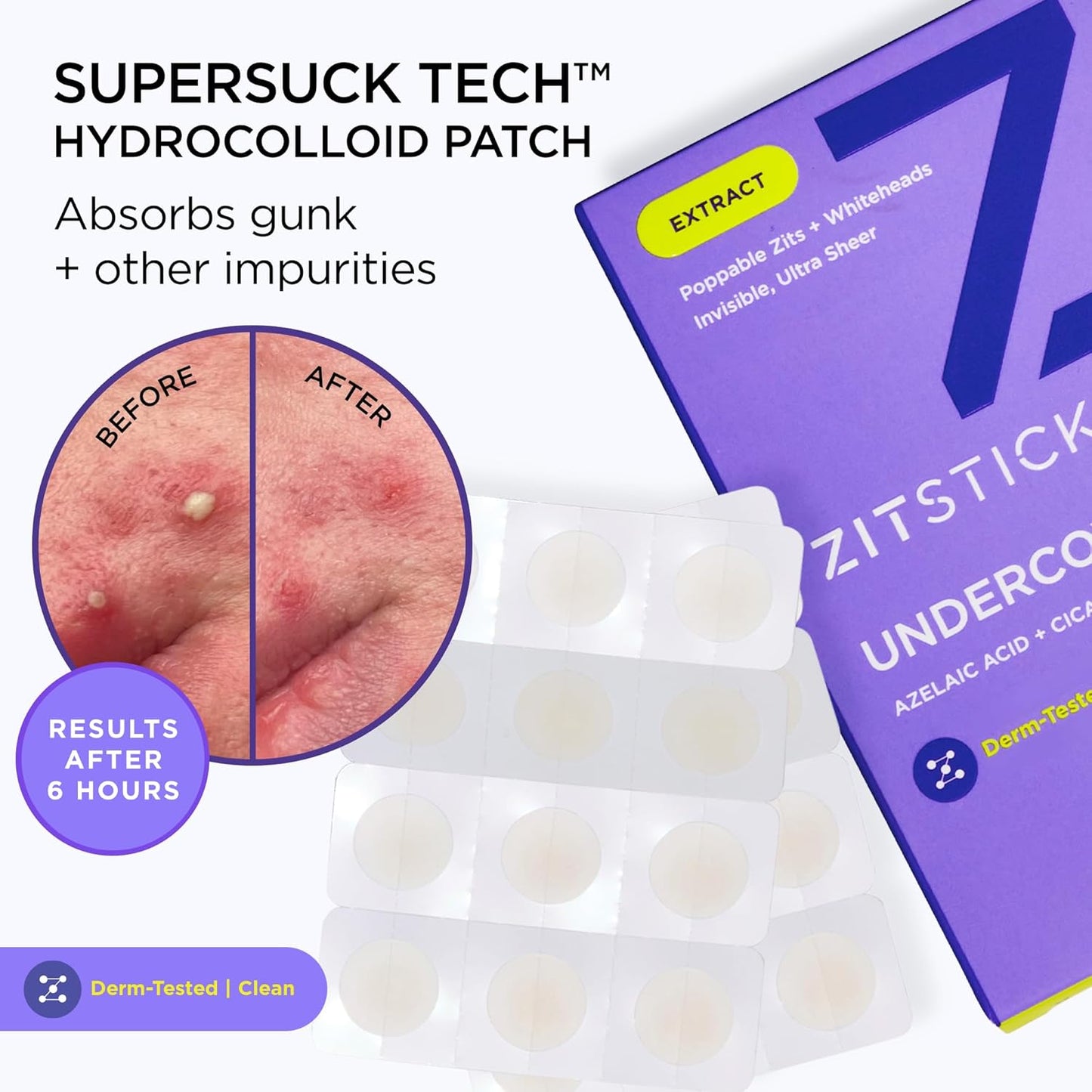 ZitSticka Invisible Pimple Patches for Face, Hydrocolloid Patches, Ultra-Thin Clear Azelaic Acid & CICA Blemish Patches, Pimple Stickers (UNDERCOVER 36 Count)