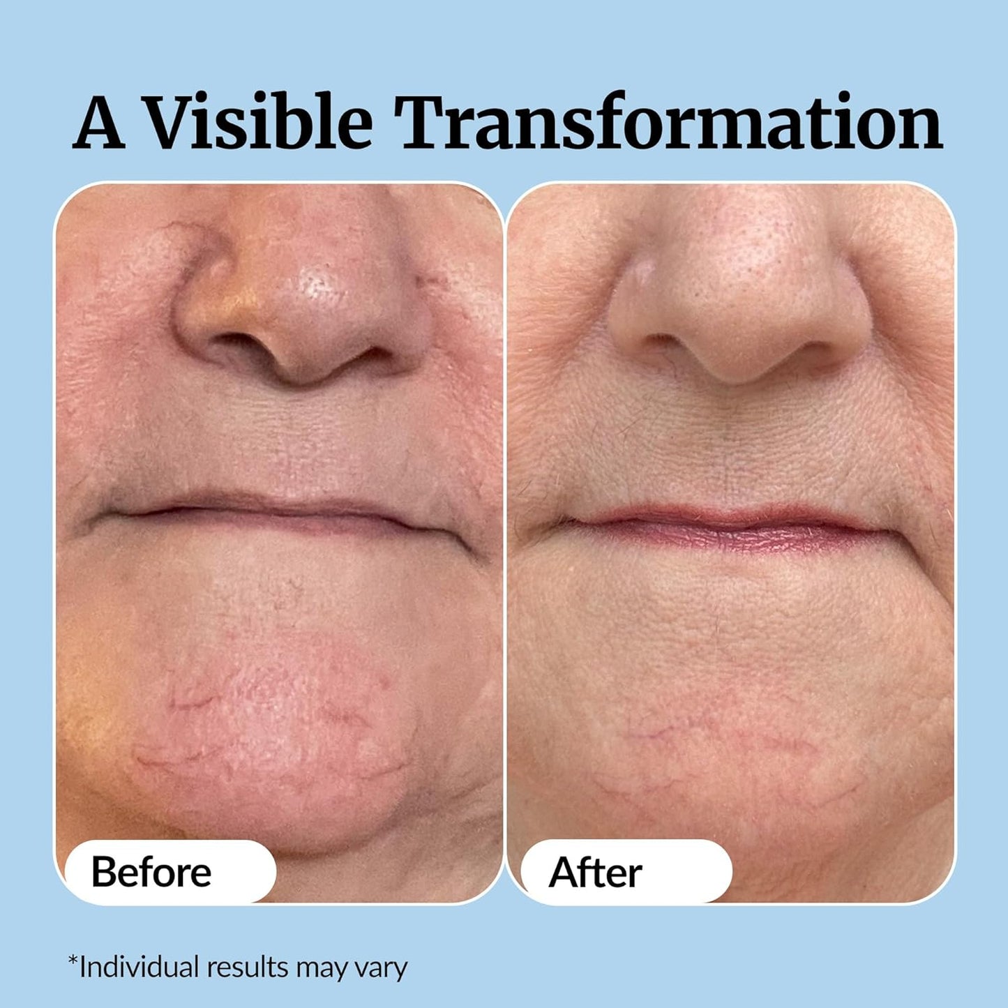 Vibriance Super C Serum for Mature Skin - All-in-One Vitamin Formula Hydrates, Firms, Lifts, Smooths, Targets Age Spots, Wrinkles, 1 fl oz