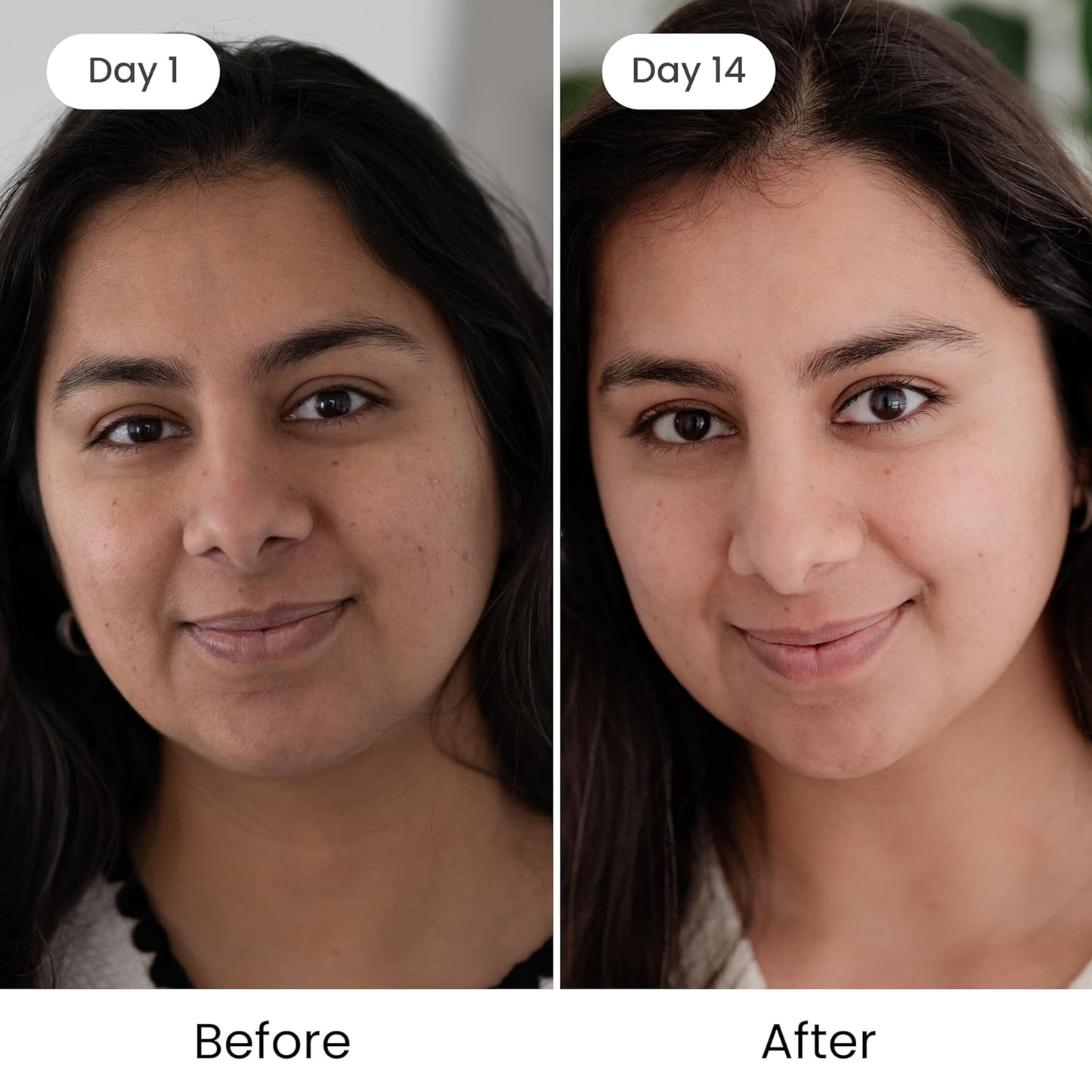 Shankara Kumkumadi Oil with Pure Saffron and Ayurvedic Herbs (Original Aroma 18ml)