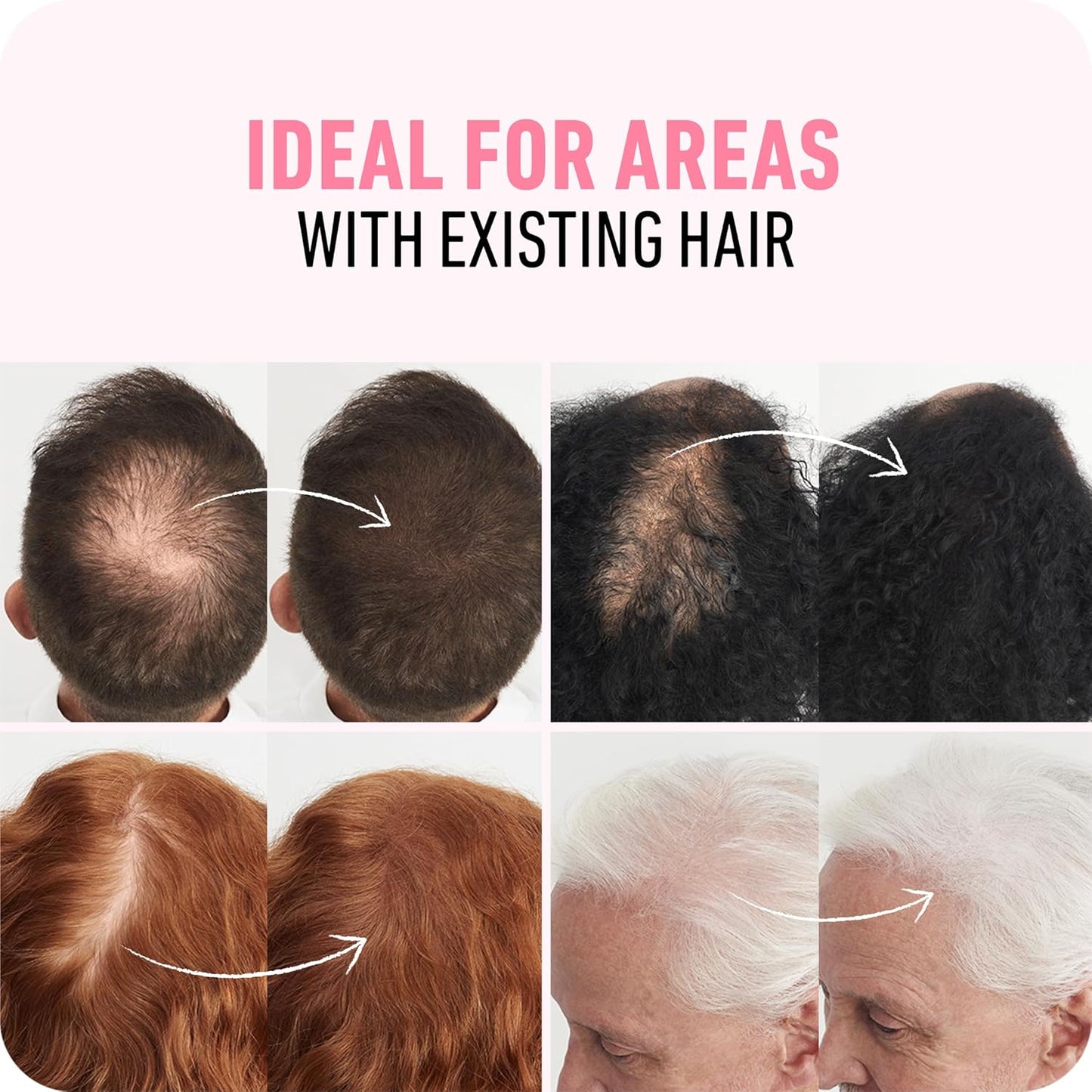 BOLDIFY Hair Fibers (28g) - Fill In Thinning and Fine Hair for an Instantly Fuller, Thicker Look - 14 Shades for Women & Men - White