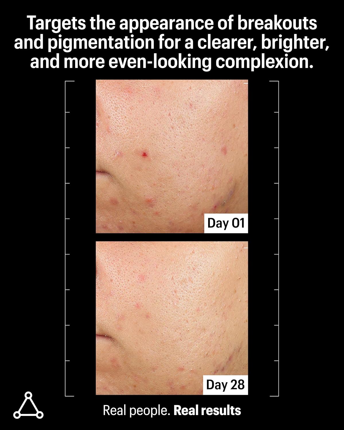 Allies of Skin Azelaic & Kojic Clarifying Face Serum | Clinically Proven for Acne & Blemish Prone Skin |10% Azelaic Acid Treats Pigmentation and Redness | Targets Pores & Uneven Skin Texture (1 Fl oz)