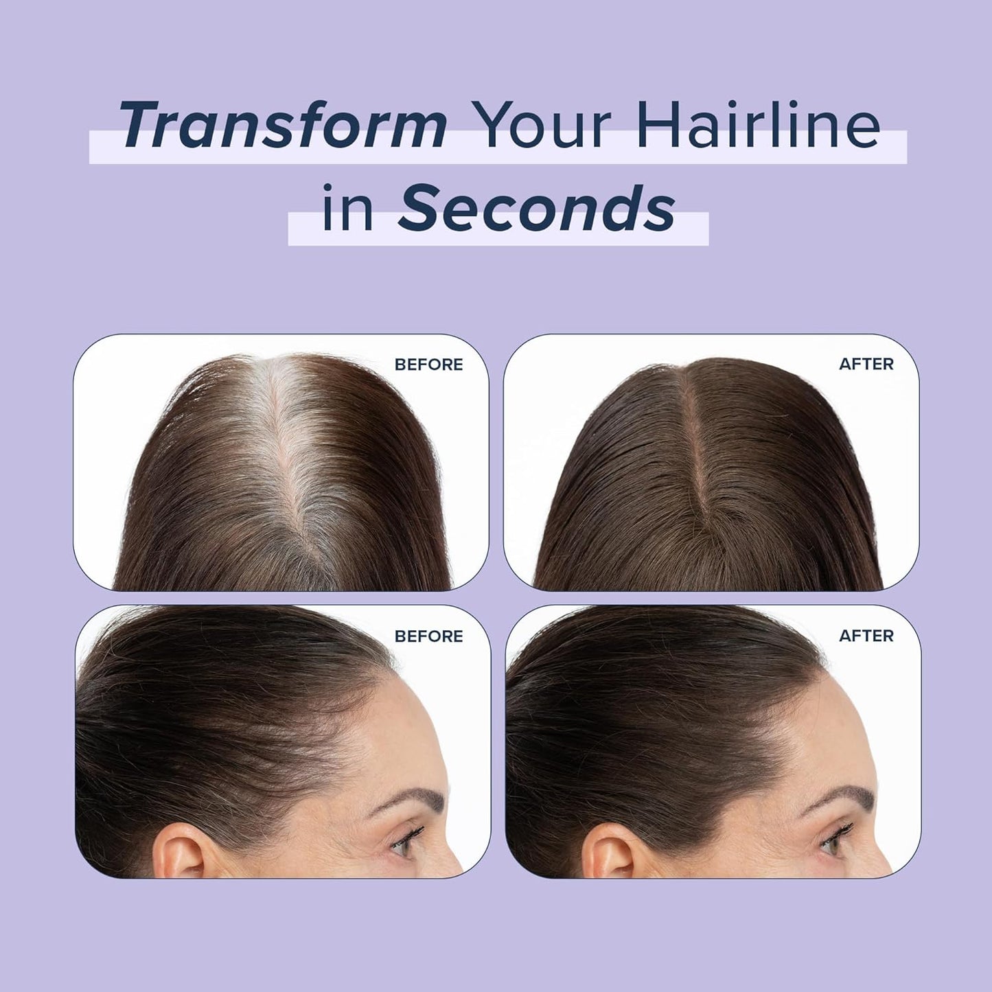 TRUHAIR Root & Scalp Cover Up Pressed Powder Compact Refill, Waterproof, Weightless Hair Coverage & Bald Spot Concealing, Root Touch Up Hair Color for Gray Coverage & Thinning Areas, 0.35 Oz (Black)