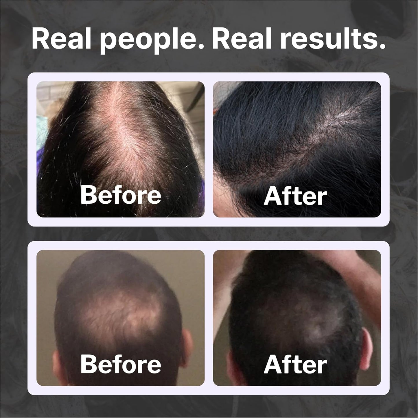 Shapiro MD Hair Growth Experts Hair Loss Shampoo | DHT Fighting Vegan Formula for Thinning Hair Developed by Dermatologists | Experience Healthier, Fuller and Thicker Looking Hair | 4 Month Supply