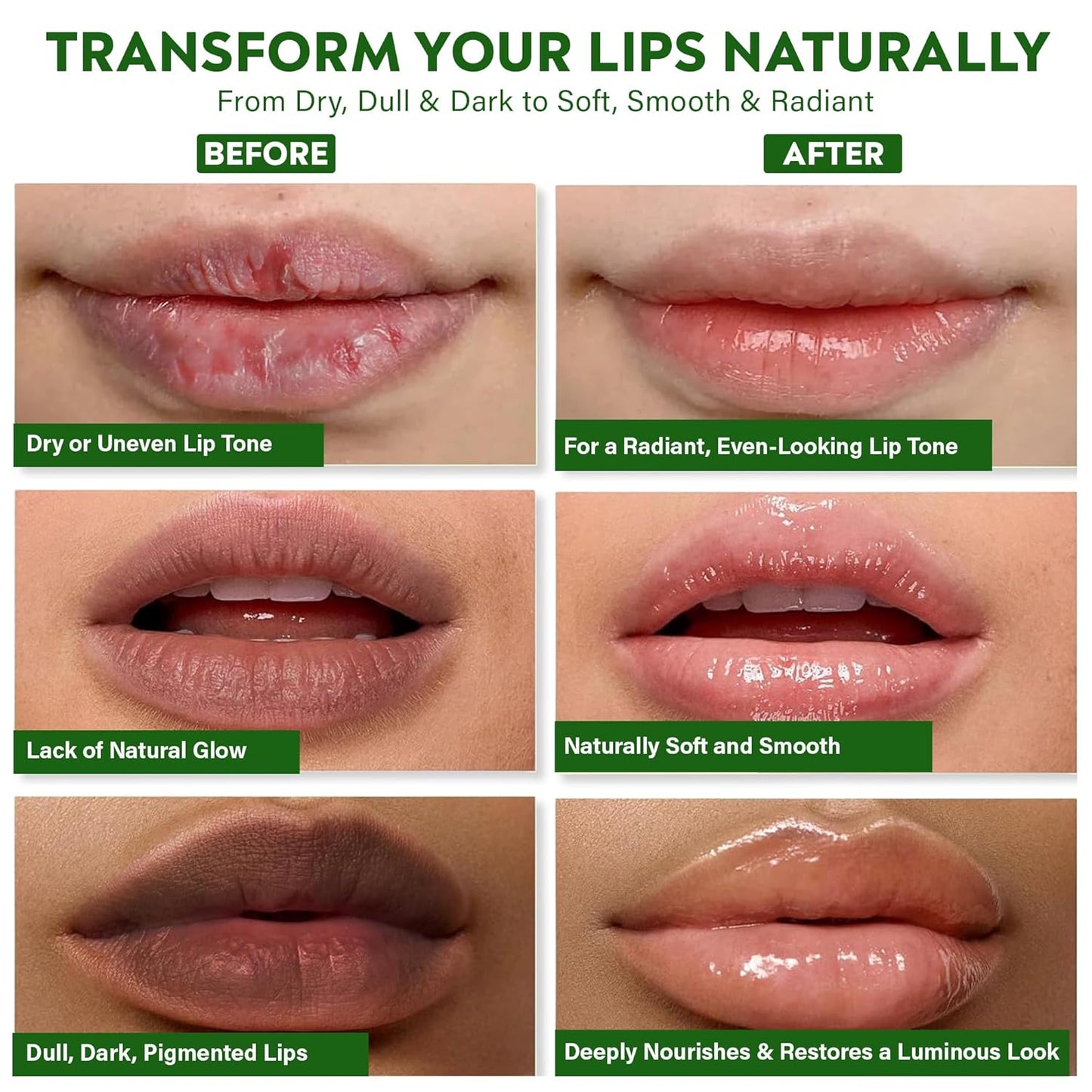 Vegan Ayurvedic Lip Balm – Naturally Lightens Dark Lips & Brightens Tones – Deeply Hydrating & Moisturizing for Dry, Chapped Lips – Plant-Based